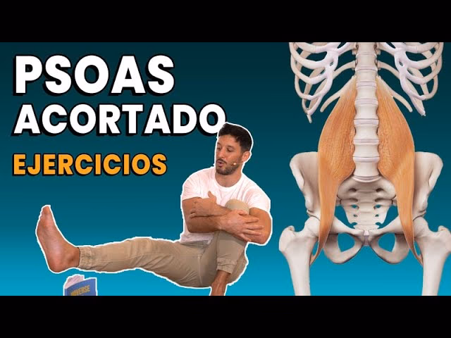 ¿Puede la acupuntura ayudar al síndrome del psoas?