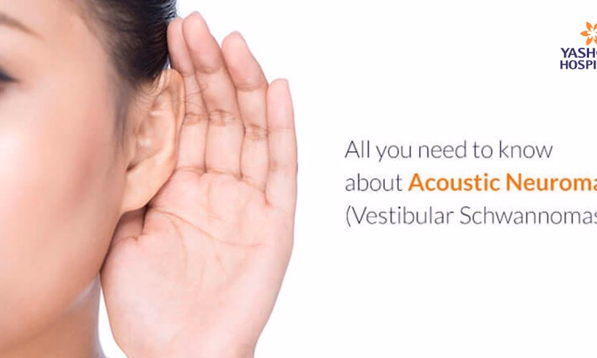 What is the best treatment for acoustic neuroma?
