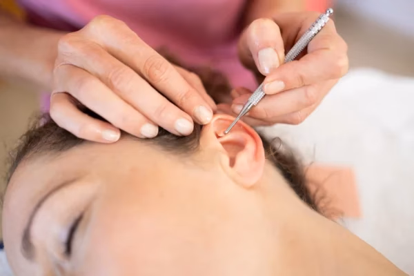 ¿Qué es la acupuntura naet?