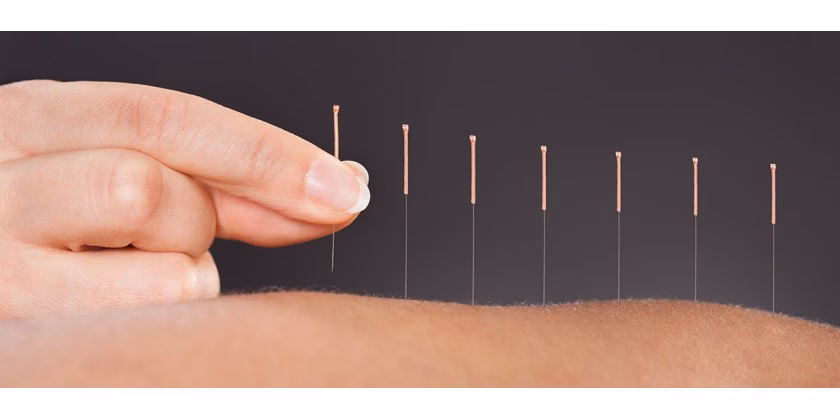 ¿Cuántas veces puedo ir al podólogo con Adeslas?