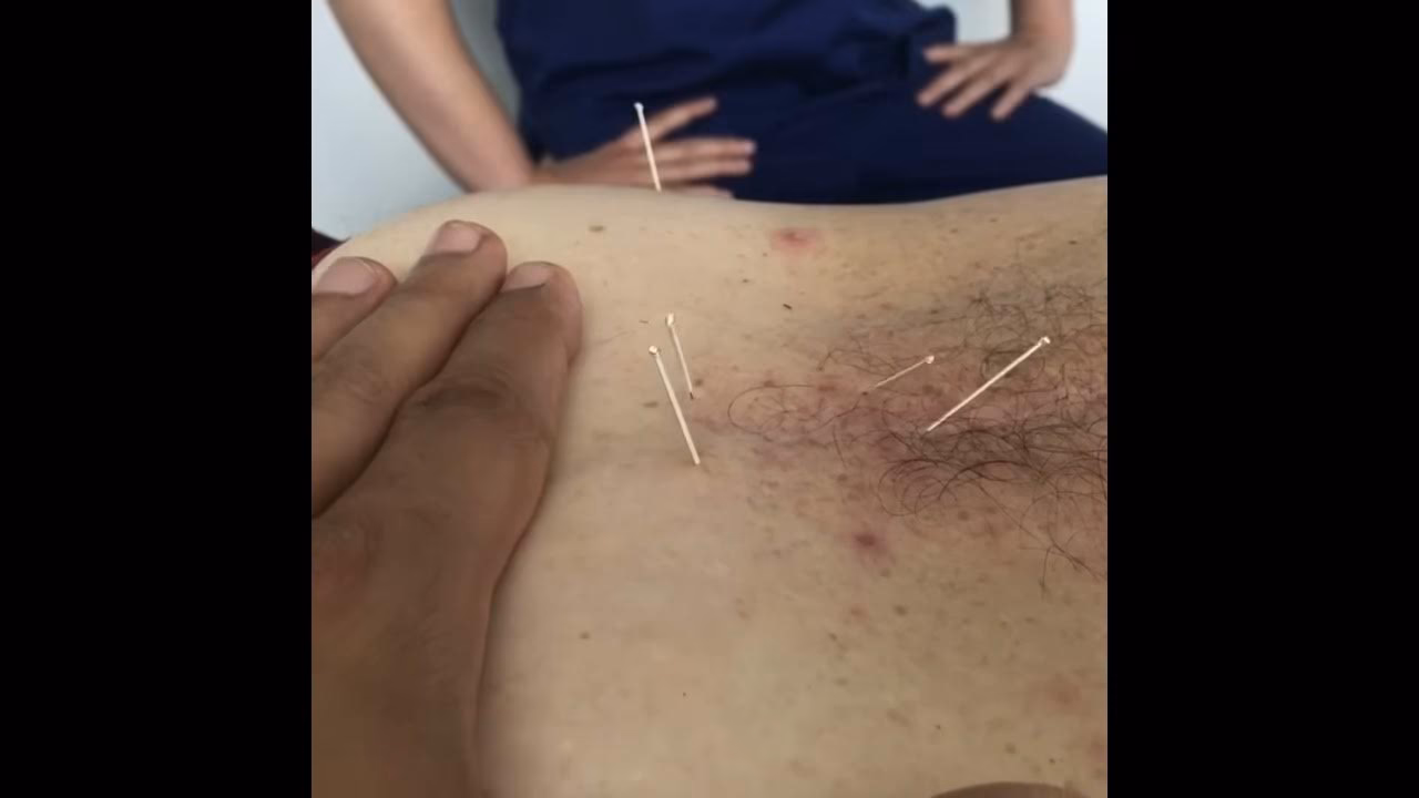 ¿Cuál es la mejor manera de romper las adherencias?