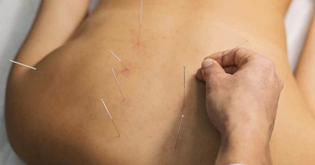 Como desinflamar o corpo da fibromialgia?