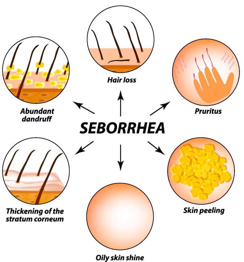 Can hair loss from androgenic alopecia grow back?
