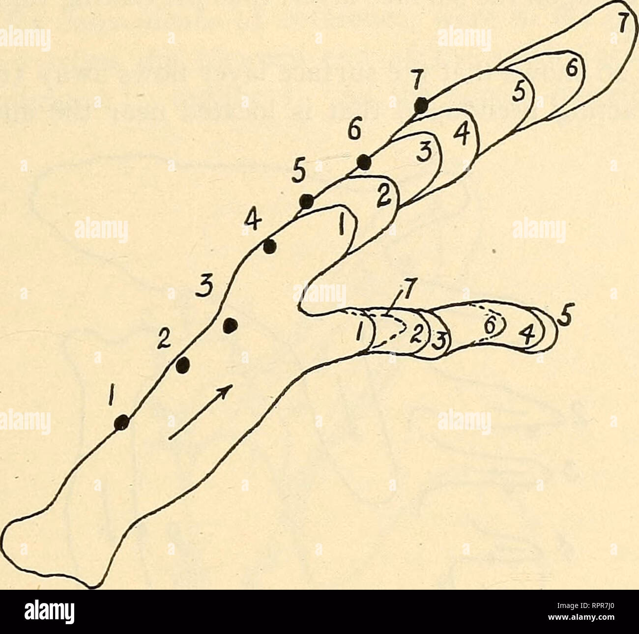 What foods should you avoid if you have amoeba?