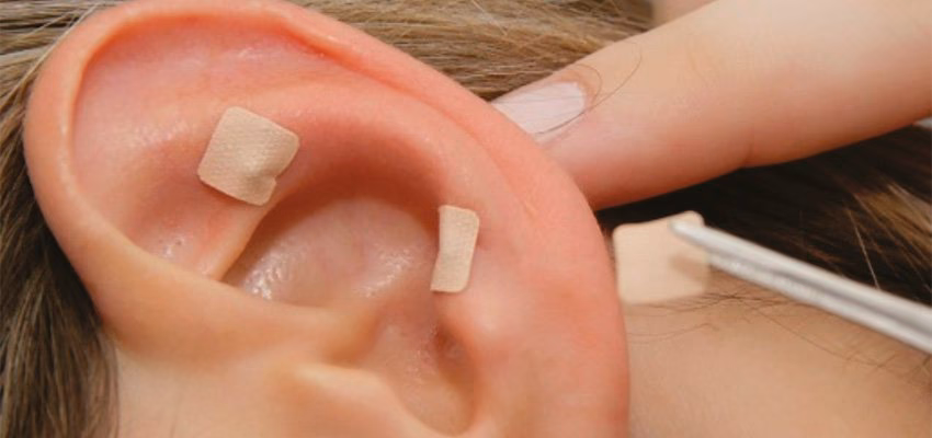 Quando a auriculoterapia é indicada?