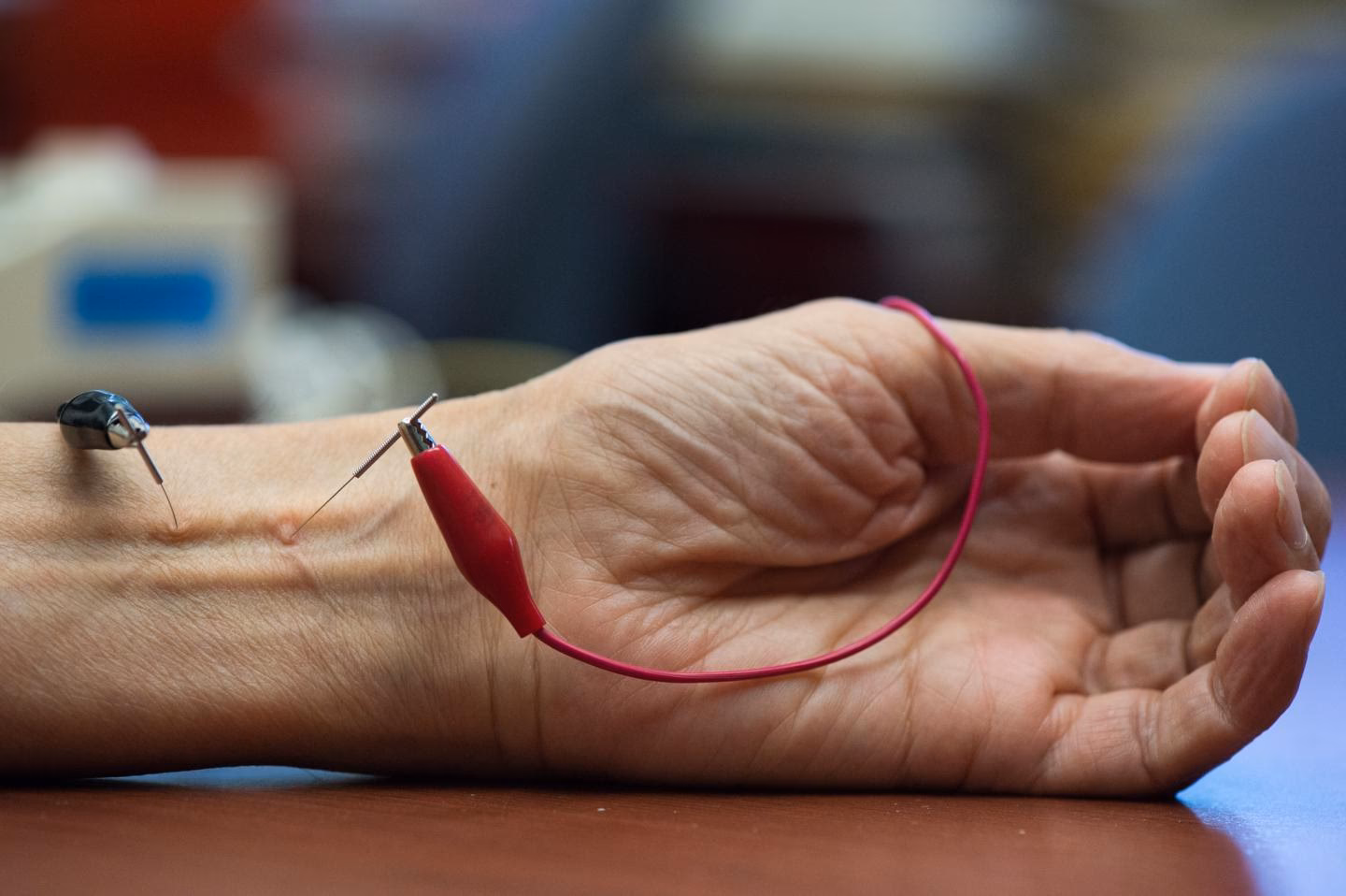 What is the acupuncture point for high blood pressure?