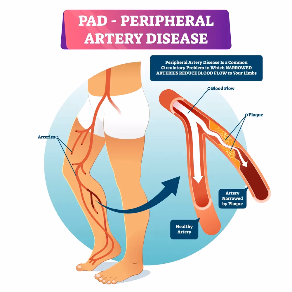 What Chinese medicine is good for blood circulation?