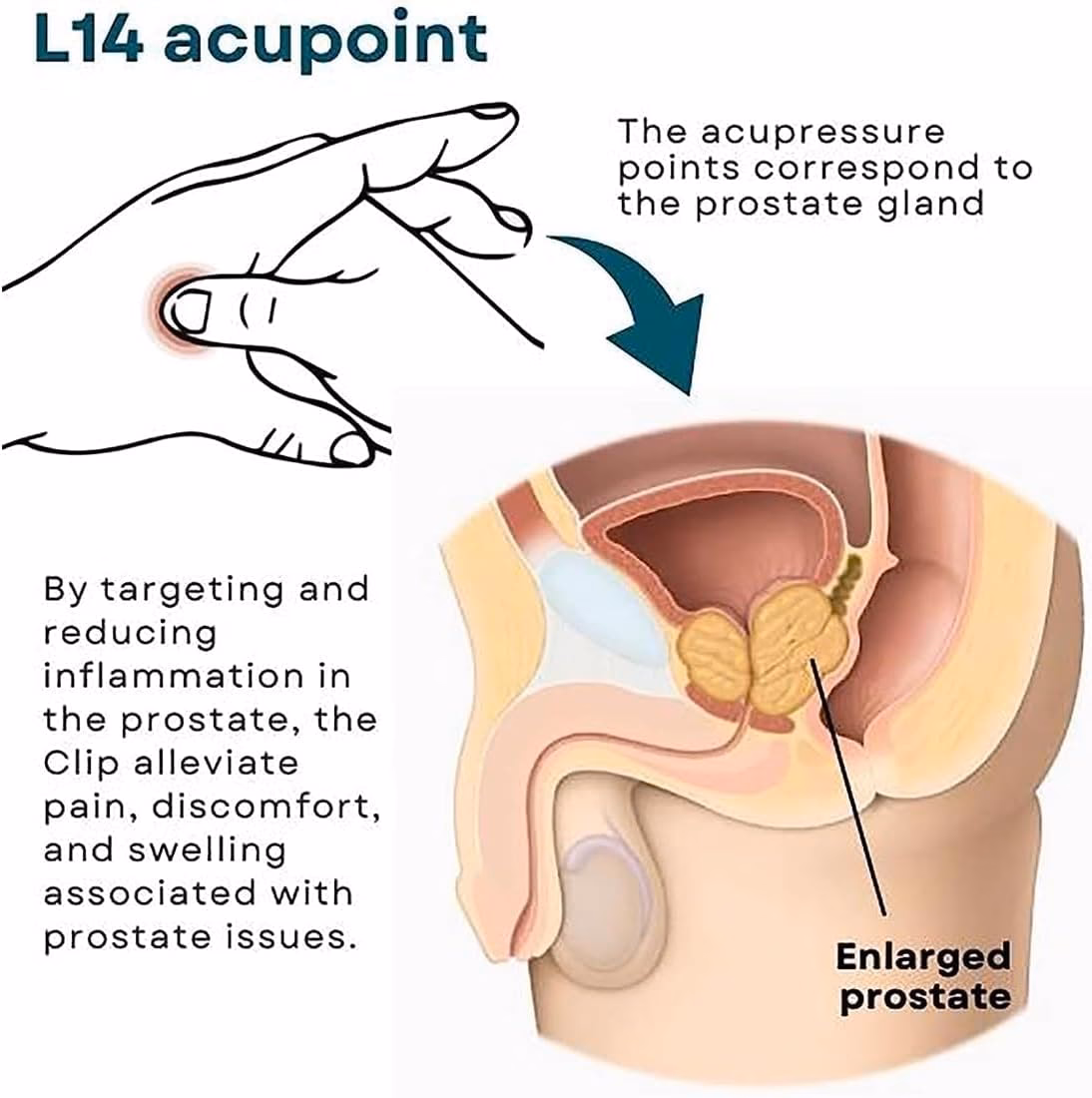 Can a man live 10 years with metastatic prostate cancer?