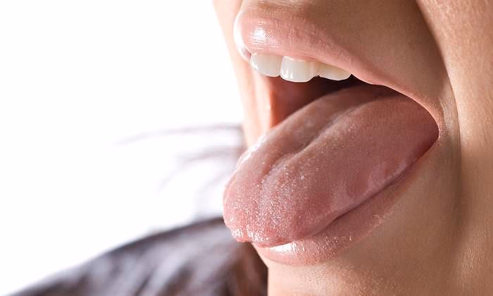 ¿Qué remedio casero sirve para la lengua?
