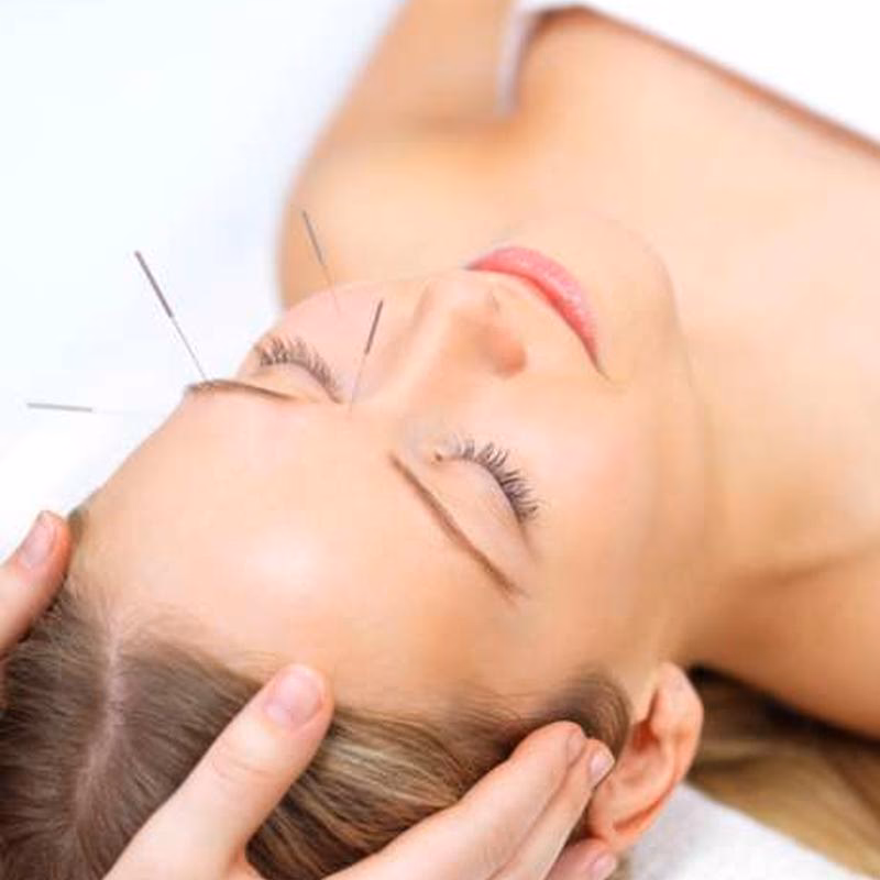 Can acupuncture help with dental issues?