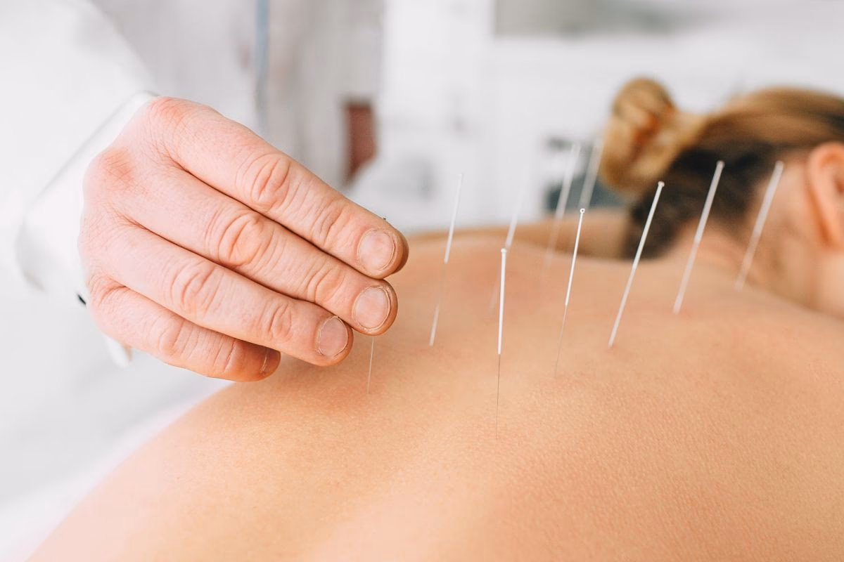 ¿Qué toman los chinos para el estreñimiento?