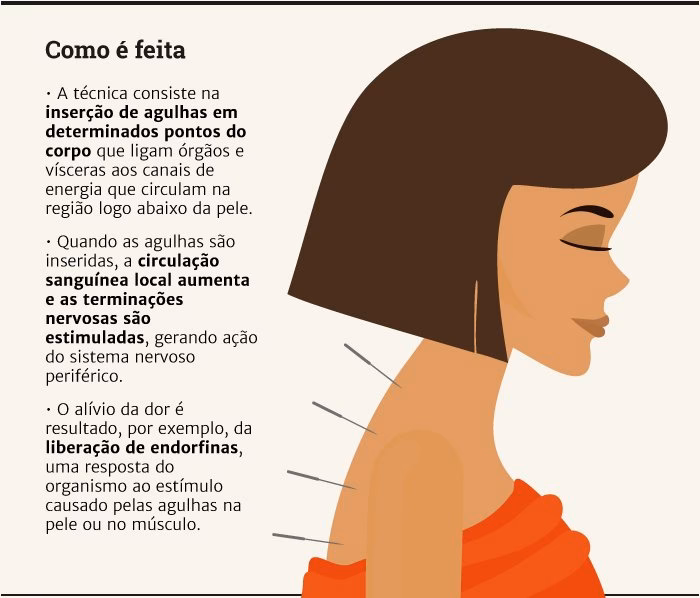 Como a acupuntura faz efeito?