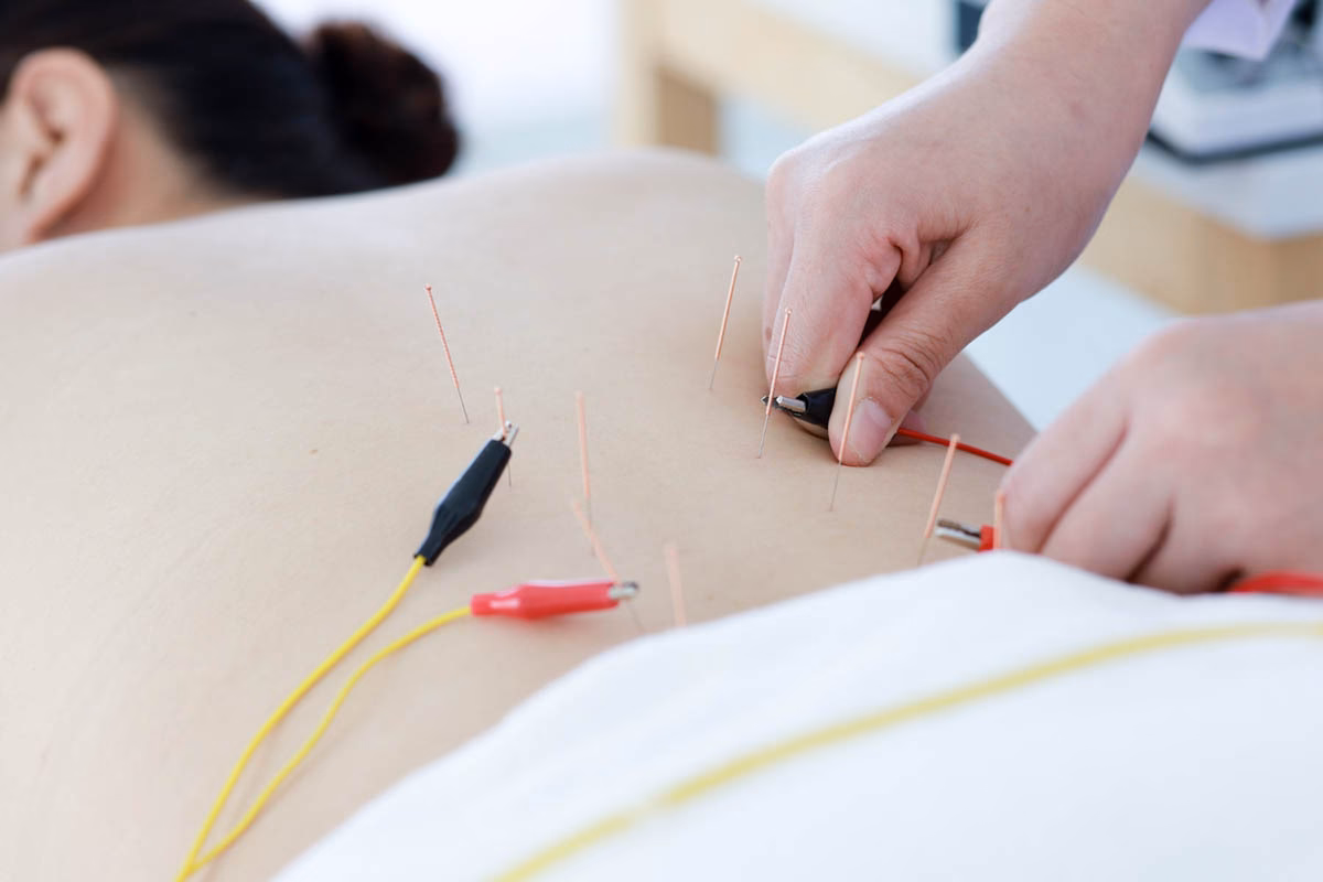 Does acupuncture reduce oxidative stress?
