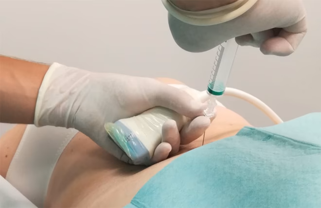 ¿Qué dolores quita la ozonoterapia?