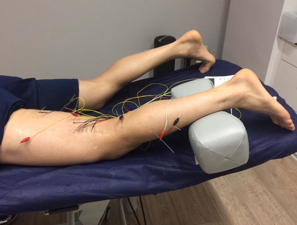 ¿Qué es el tratamiento con corriente galvánica?