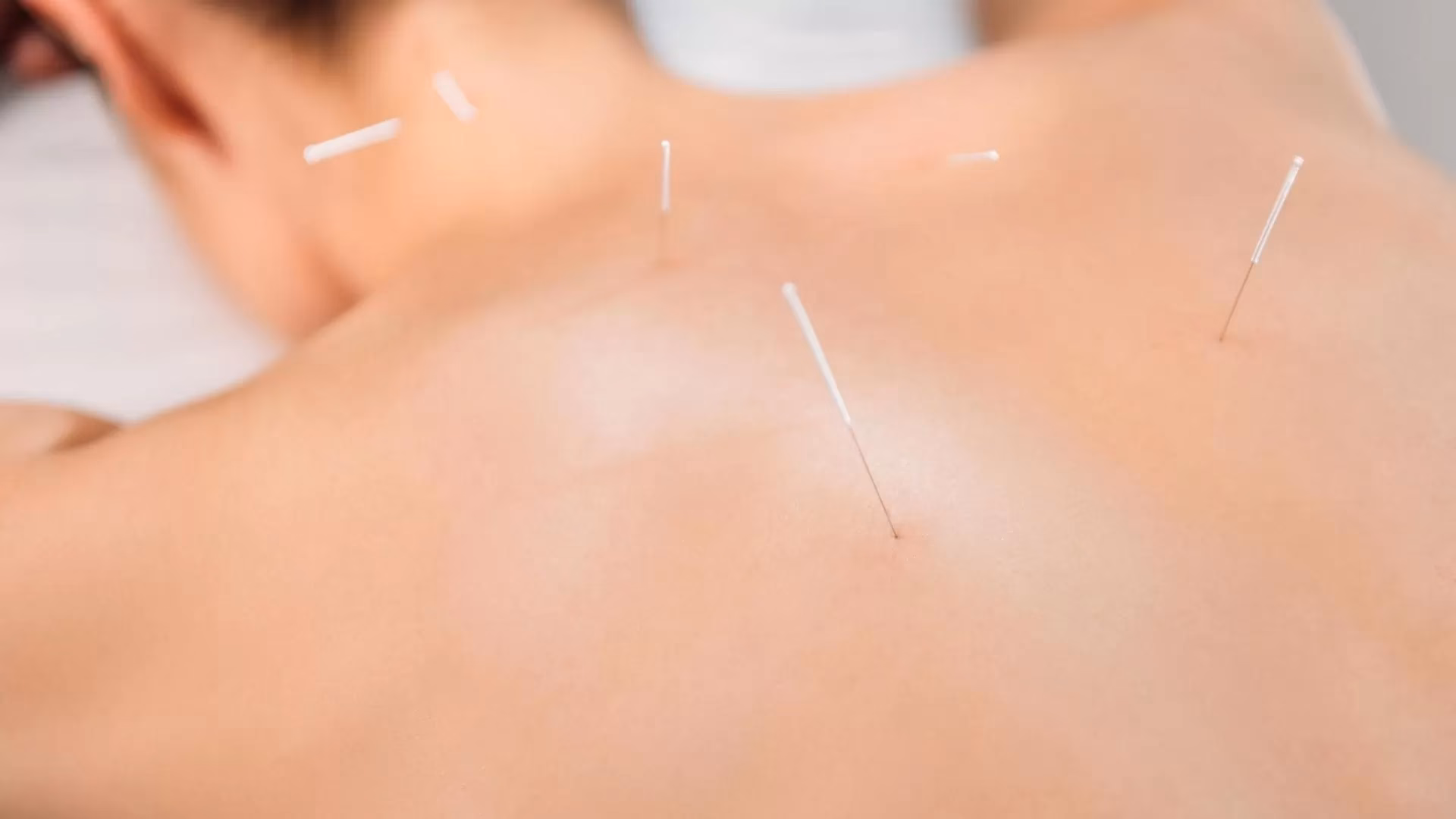 Can antioxidants cure varicocele?