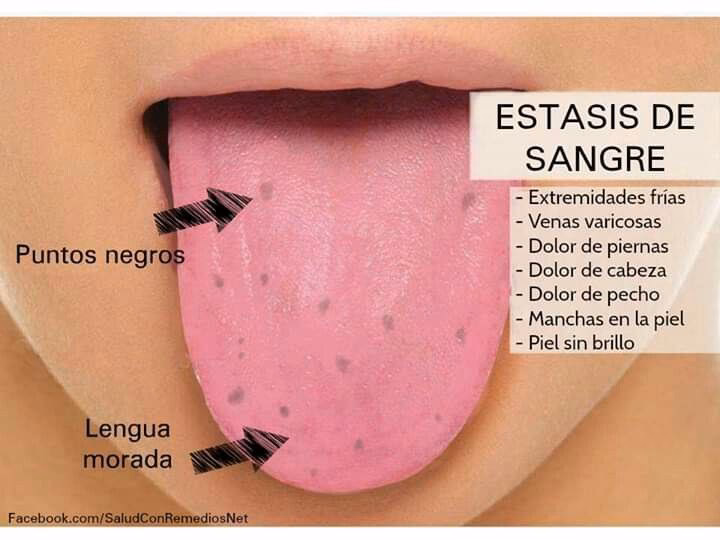 ¿Cómo sacar el dolor de la lengua?