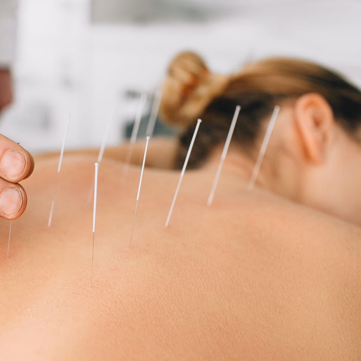 Quem faz acupuntura é doutor?