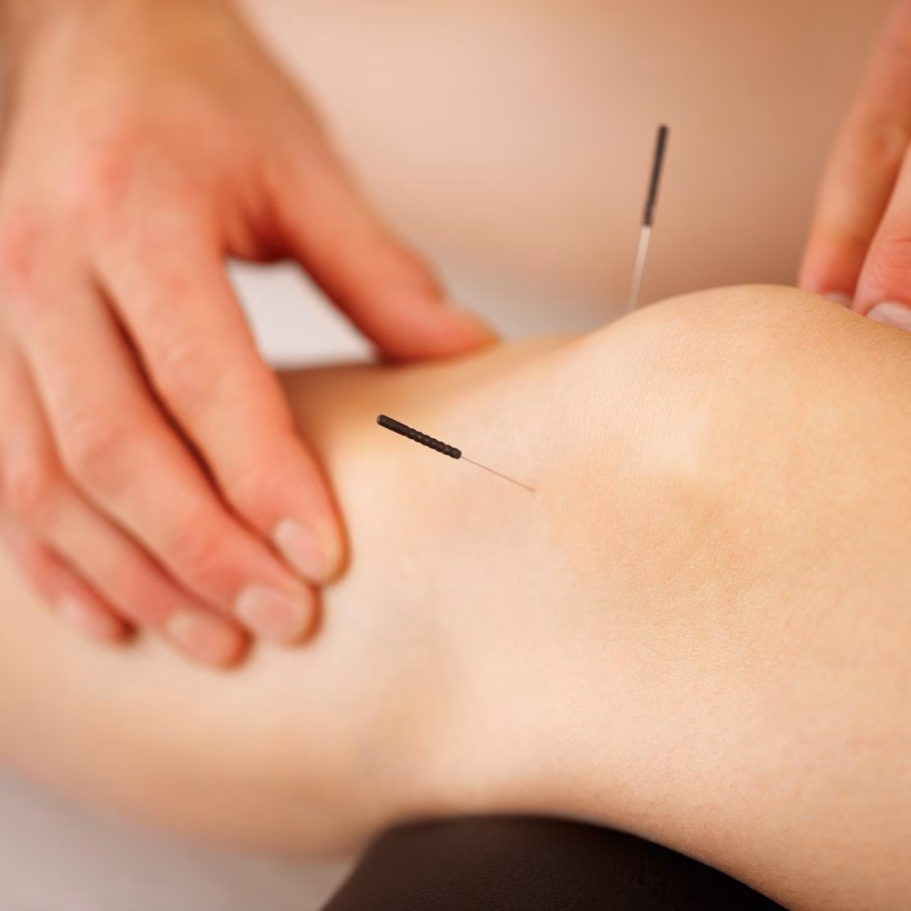 ¿Cómo bajar de peso un bariátrico?