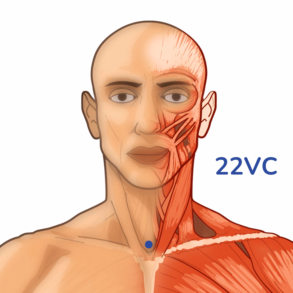 What is the name of the Korean acupuncture?