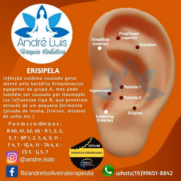 ¿Cómo desinflamar una pierna con erisipela?