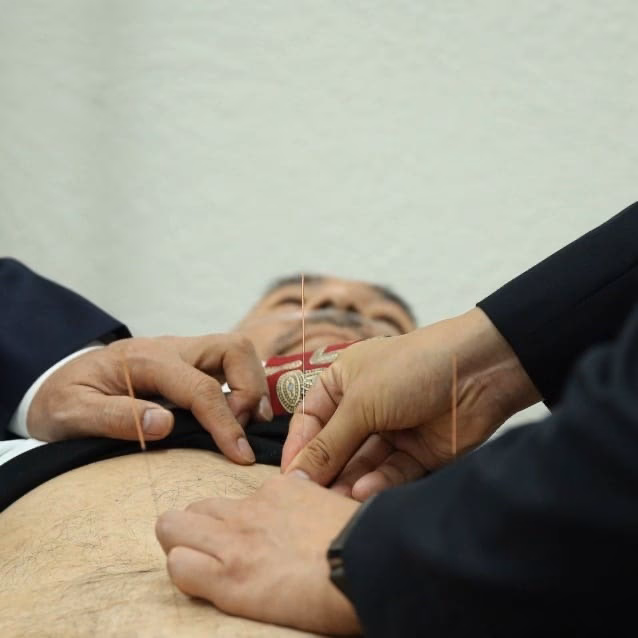 ¿La cobertura médica cubre la acupuntura?