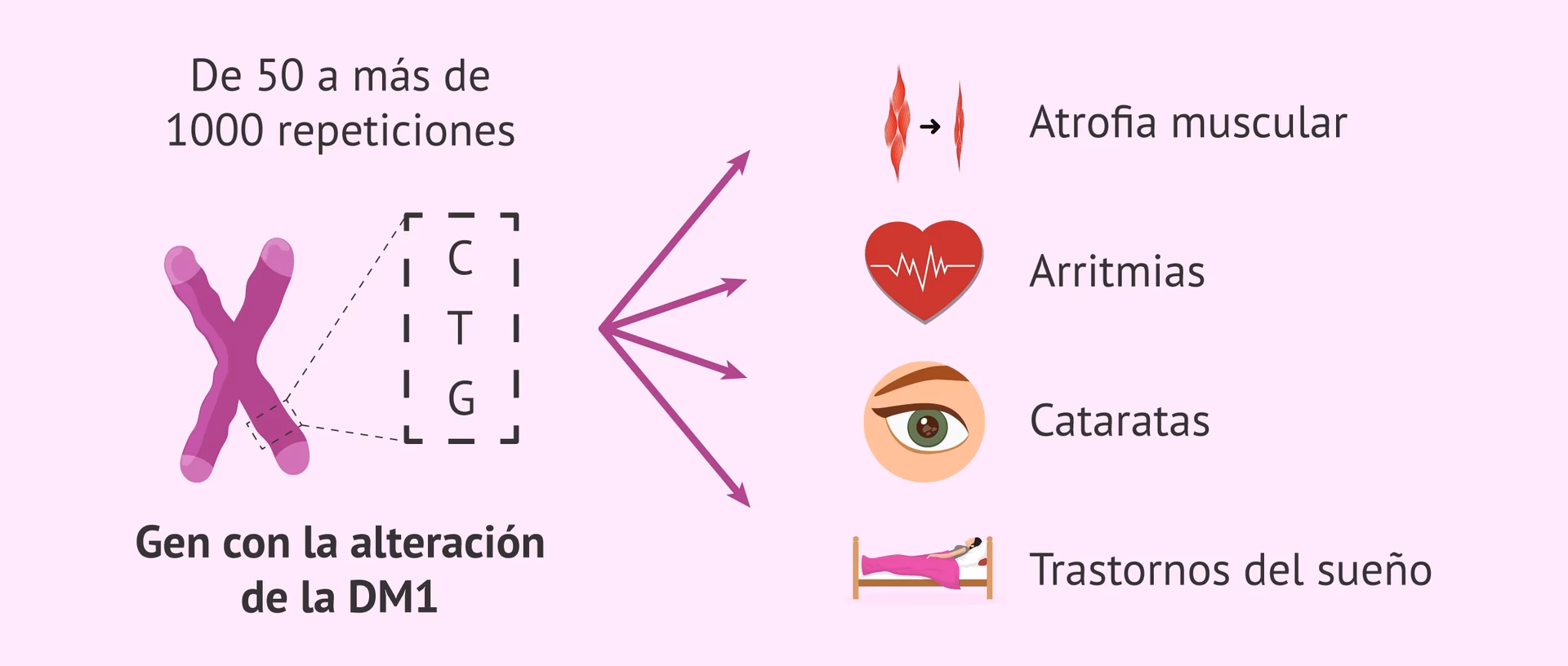¿Cómo tratar la miotonía?