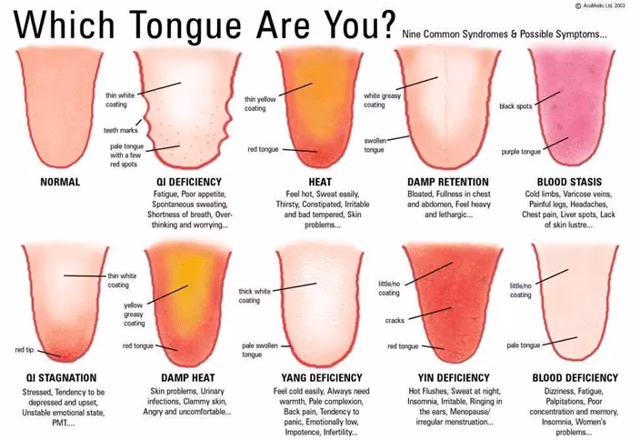 ¿Qué ven los médicos chinos en la lengua?