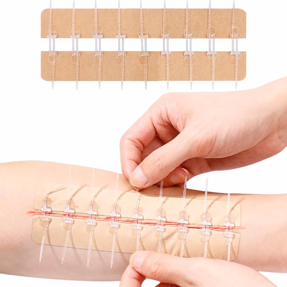 ¿Cómo curar la epidermolisis?