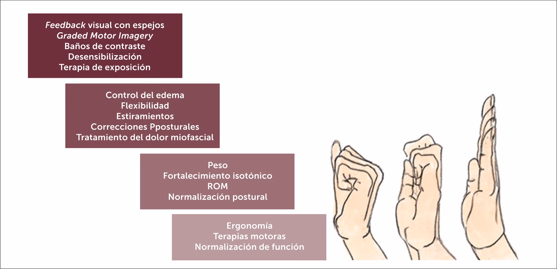 ¿Puede la acupuntura ayudar al síndrome de dolor regional complejo?