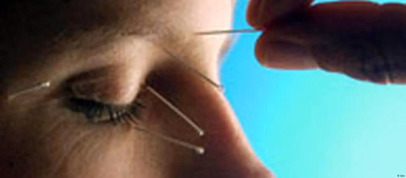 How much is acupuncture in Vietnam?