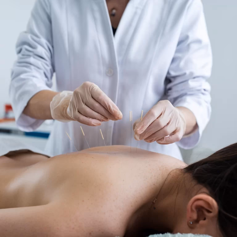 Did acupuncture originate in India?