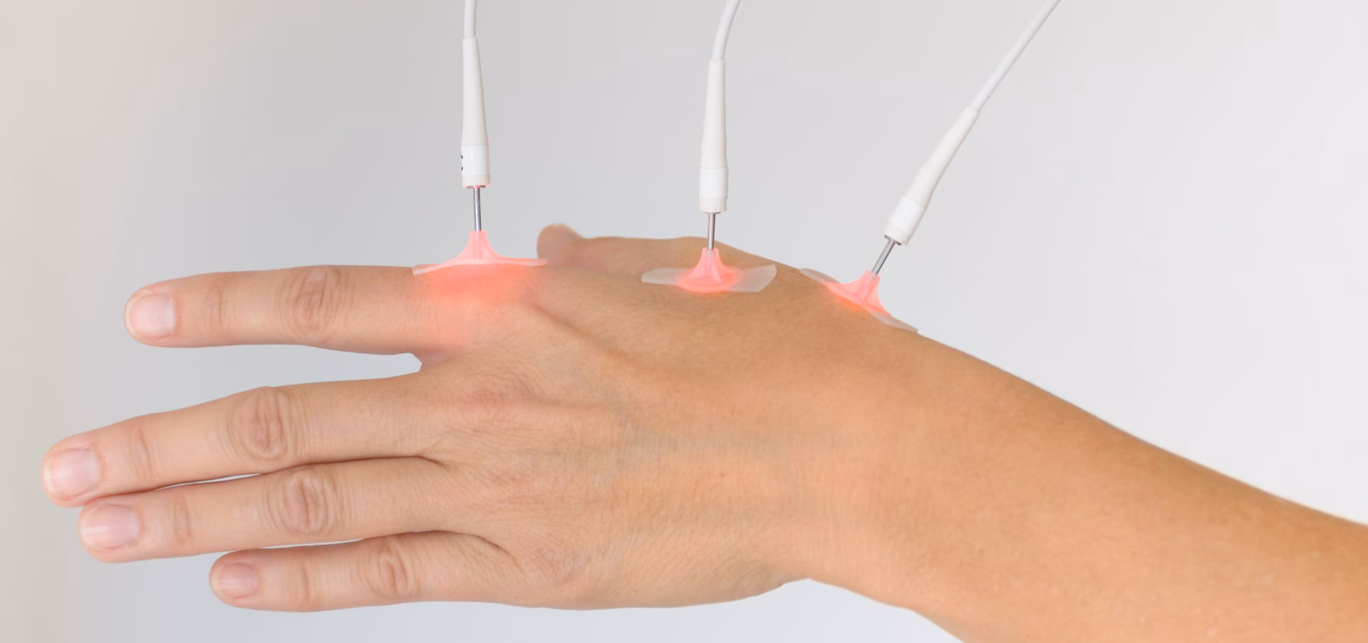 Quais são os benefícios da acupuntura a laser?