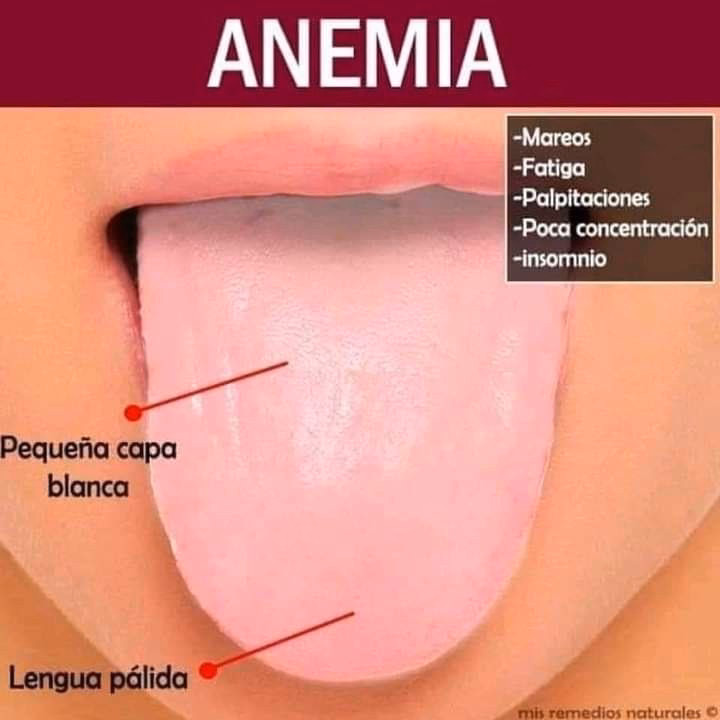 ¿Cómo desmanchar la lengua blanca?