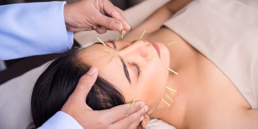 Can acupuncture help sagging jowls?