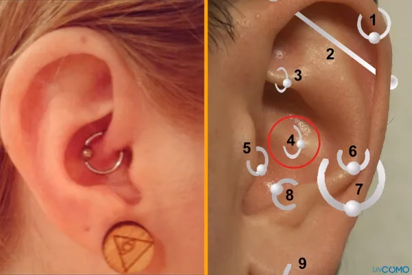 ¿Qué oreja se perfora para la migraña?