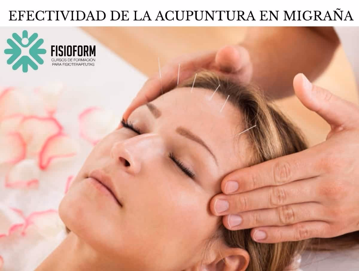¿Cuál es el método chino para las migrañas?