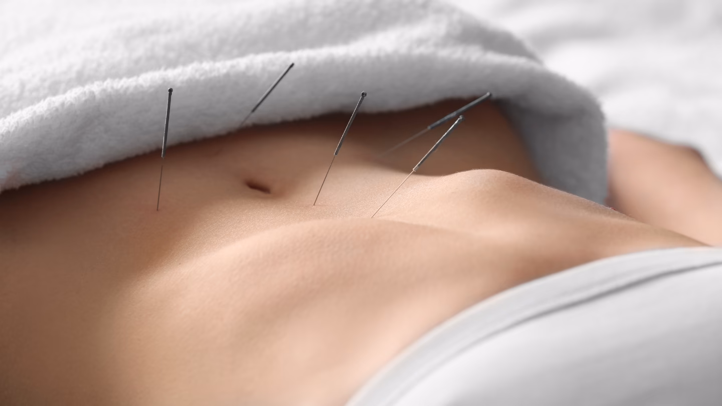 ¿Es real un doctor en acupuntura?