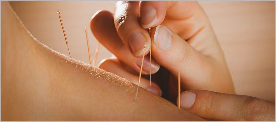 How much do you pay for acupuncture?