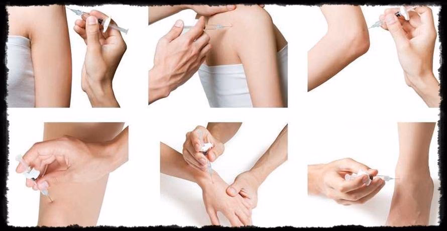 ¿Cuál es el tratamiento más eficaz para la apnea central del sueño?