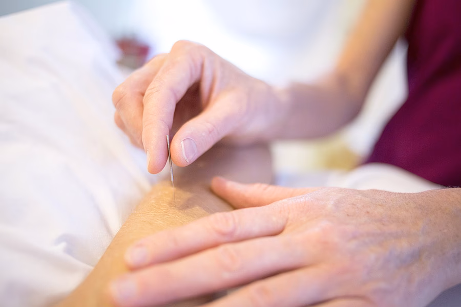 Can you get an acupuncture license online?