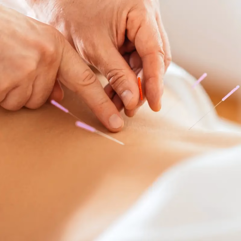 ¿Puede la acupuntura acelerar el metabolismo?