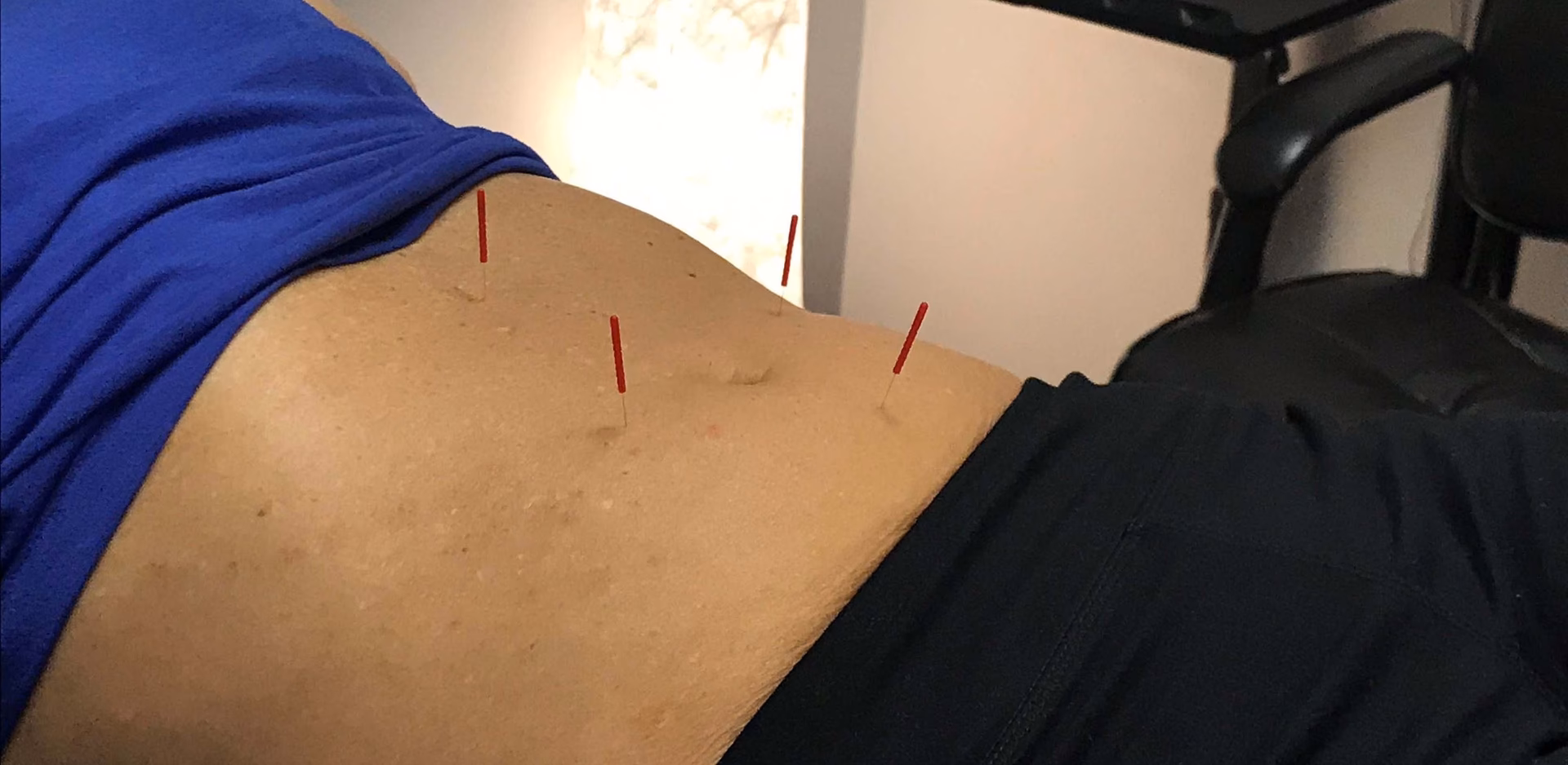 ¿Cómo se llama la terapia para bajar de peso?