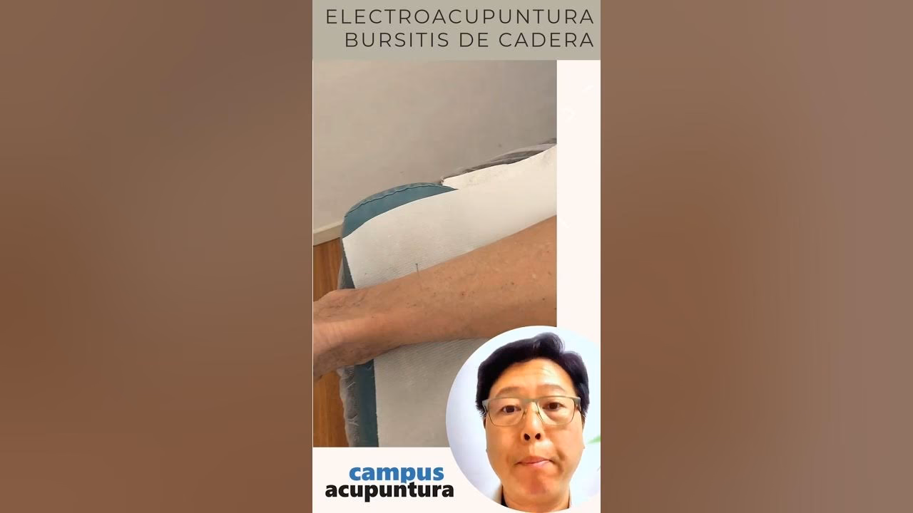 ¿Cómo desinflamar la bursa del trocánter?