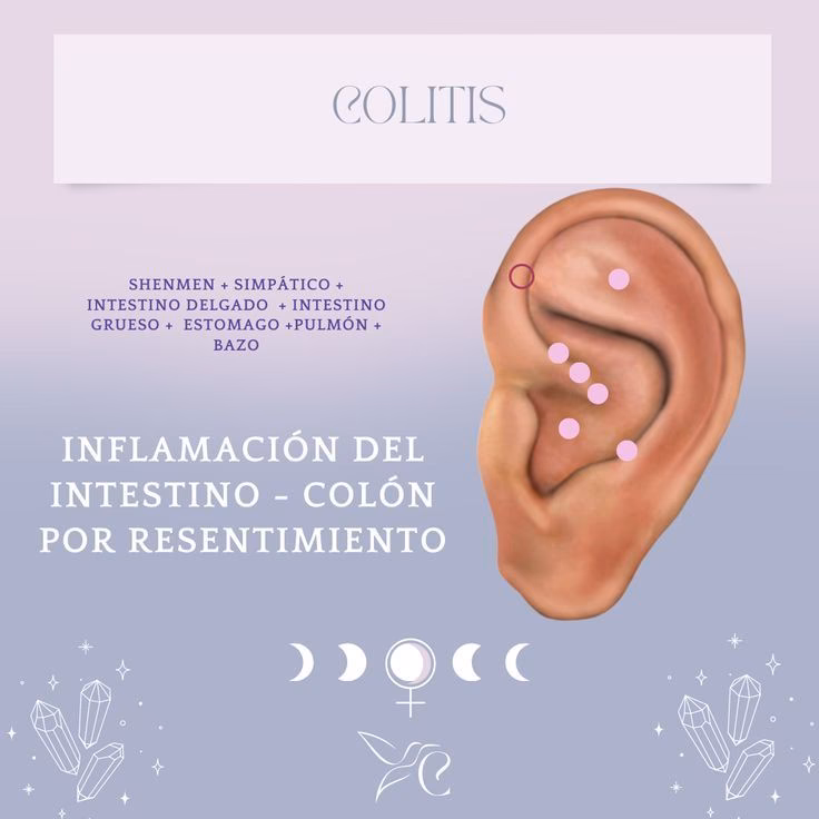 ¿Qué medicina natural cura la colitis?