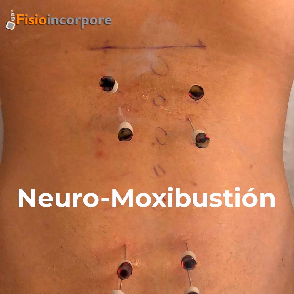 ¿Cómo quitar el dolor de la discopatía lumbar?