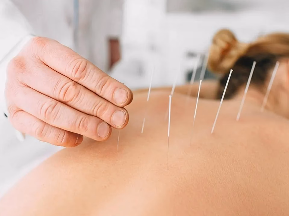 Qual o ponto da acupuntura para dor lombar?