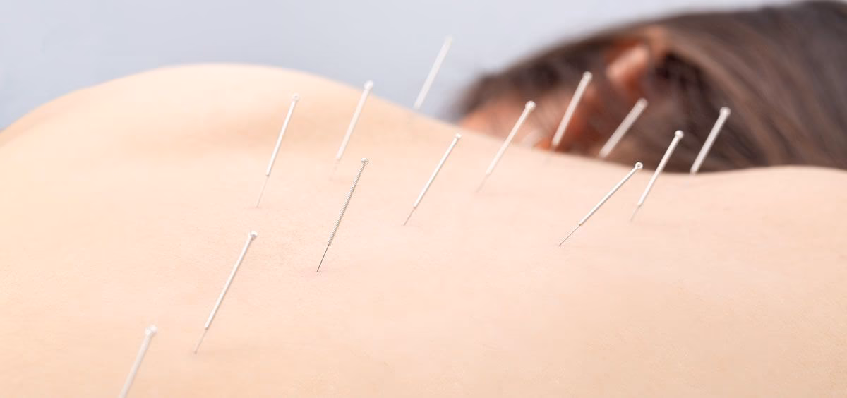 ¿Qué es bueno para el antojo?