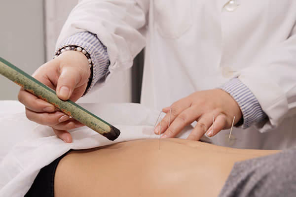 ¿Puede la acupuntura ayudar a controlar el apetito?