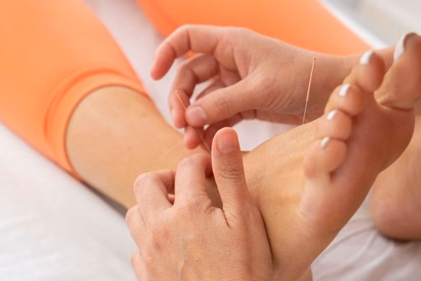 ¿Cómo se utiliza la acupuntura en el deporte?